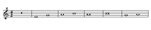 Missa In duplicibus minoribus (II) First Section Benedictus - staff notation