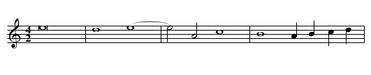Missa In te Domine speravi (1593-4) First Section Benedictus - staff notation