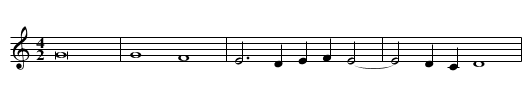 Missa Sine nomine (Mantuan) First Section Benedictus - staff notation