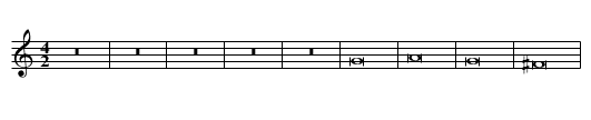 Missa Veni creator Spiritus First Section Benedictus - staff notation
