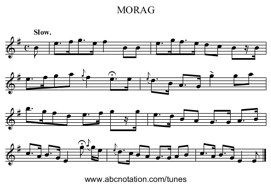MORAG - staff notation