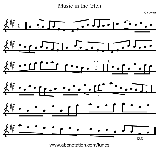 Music in the Glen - staff notation