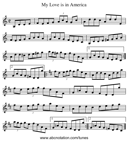 My Love is in America - staff notation