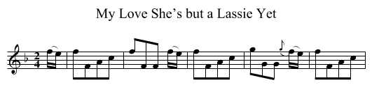 My Love She’s but a Lassie Yet - staff notation