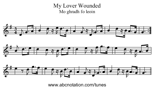 My Lover Wounded - staff notation