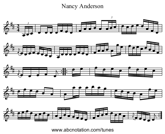 Nancy Anderson - staff notation