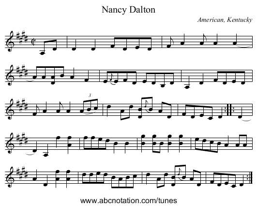 Nancy Dalton - staff notation