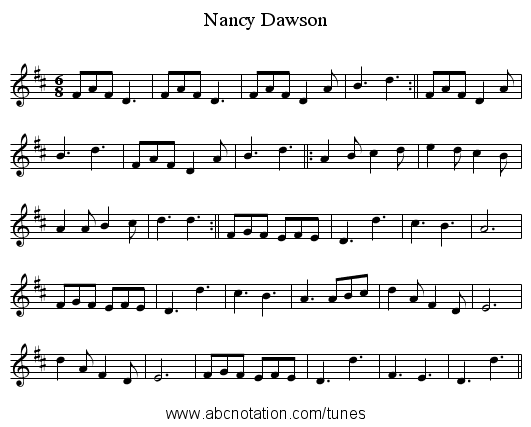 Nancy Dawson - staff notation