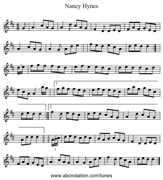 Nancy Hynes - staff notation
