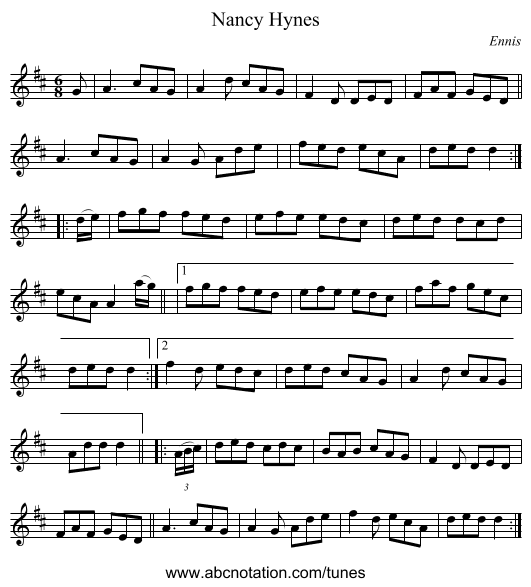 Nancy Hynes - staff notation
