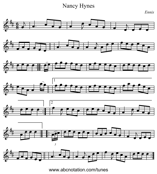 Nancy Hynes - staff notation