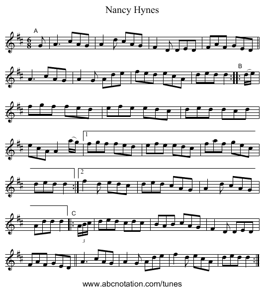 Nancy Hynes - staff notation