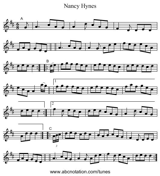 Nancy Hynes - staff notation