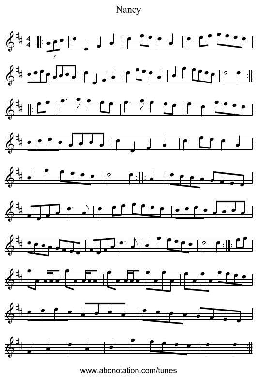 Nancy - staff notation