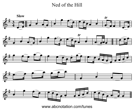 Ned of the Hill - staff notation