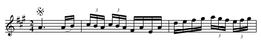 New Bedford Jig - staff notation