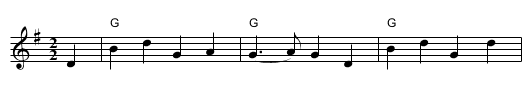 Newcastle - staff notation