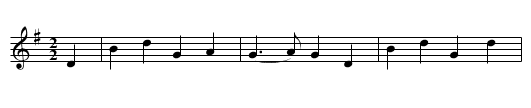NEWCASTLE - staff notation