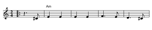 Nitzotz Ha ahava - staff notation