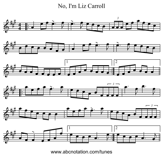 No, I'm Liz Carroll - staff notation