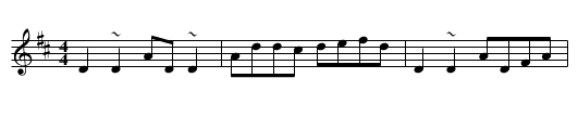 ? - staff notation