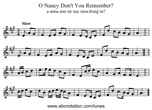 O Nancy Don't You Remember? - staff notation