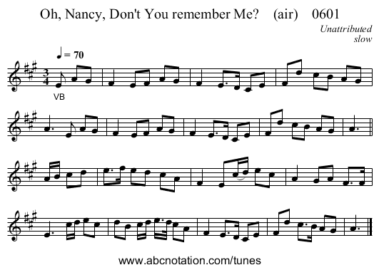 Oh, Nancy, Don't You remember Me?    (air)    0601 - staff notation