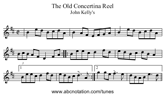 Old Concertina Reel, The - staff notation