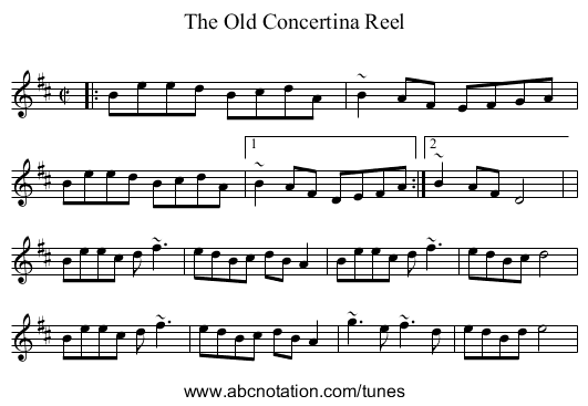 Old Concertina Reel, The - staff notation