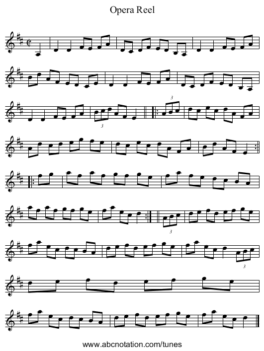 Opera Reel - staff notation