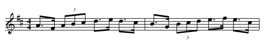 Over the Hills to Glory - staff notation
