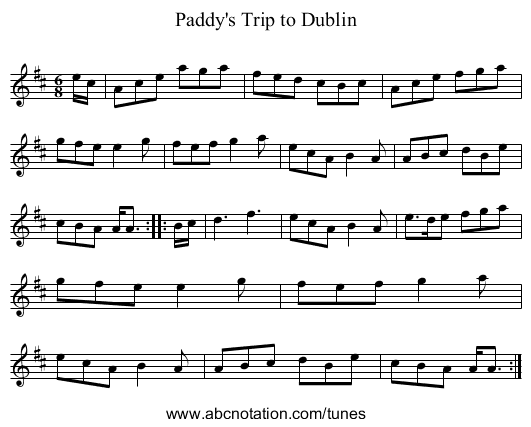 Paddy's Trip to Dublin - staff notation