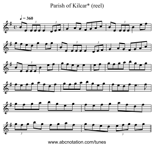 Parish of Kilcar* (reel) - staff notation
