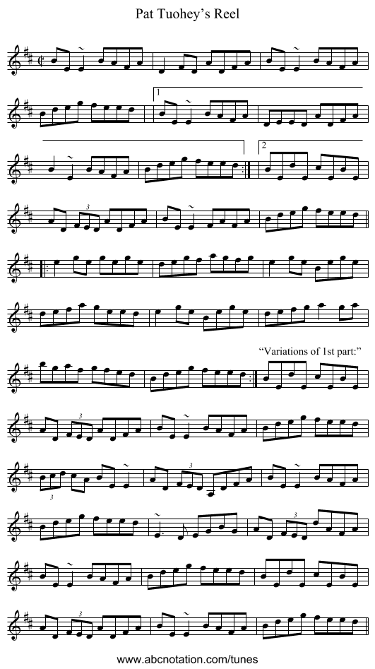 Pat Tuohey’s Reel - staff notation