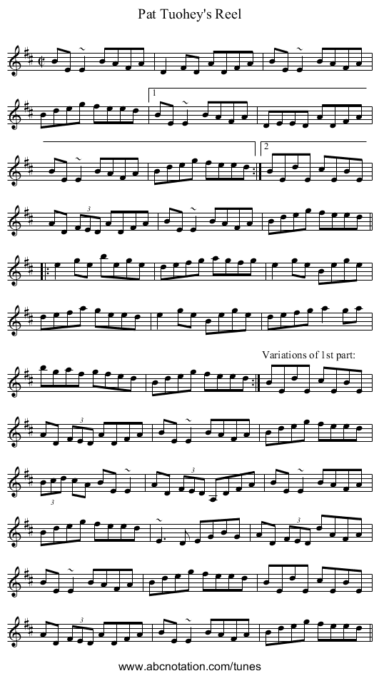 Pat Tuohey's Reel - staff notation
