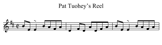 Pat Tuohey’s Reel - staff notation