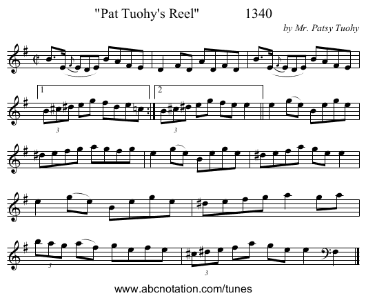 Pat Tuohy's Reel 1340 - staff notation