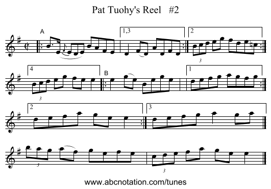 Pat Tuohy's Reel   #2 - staff notation
