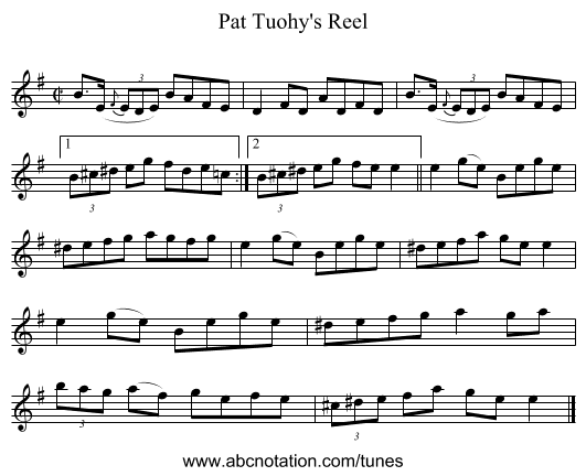 Pat Tuohy's Reel - staff notation