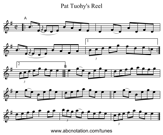 Pat Tuohy's Reel - staff notation