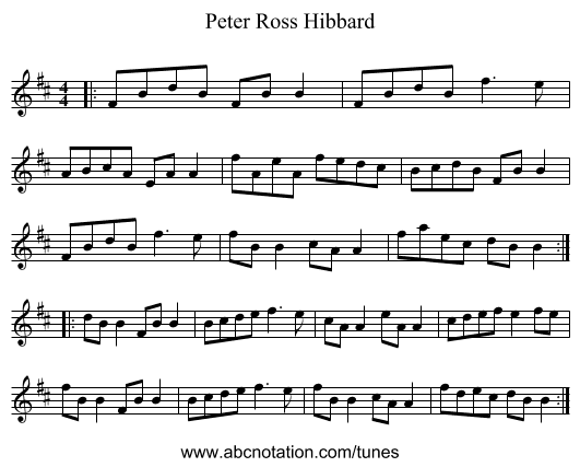 Peter Ross Hibbard - staff notation
