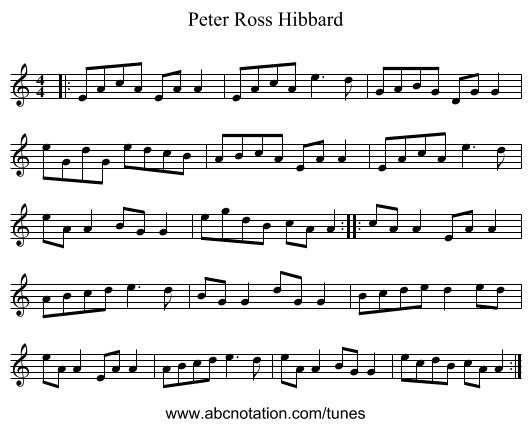 Peter Ross Hibbard - staff notation