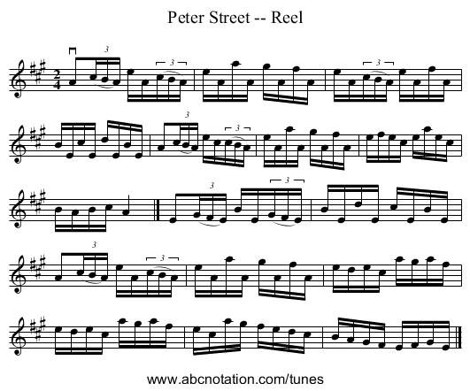 Peter Street -- Reel - staff notation