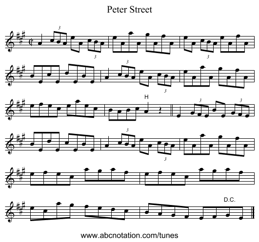Peter Street - staff notation