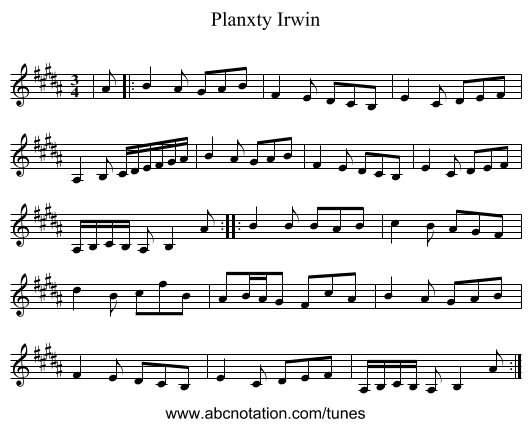 Planxty Irwin - staff notation