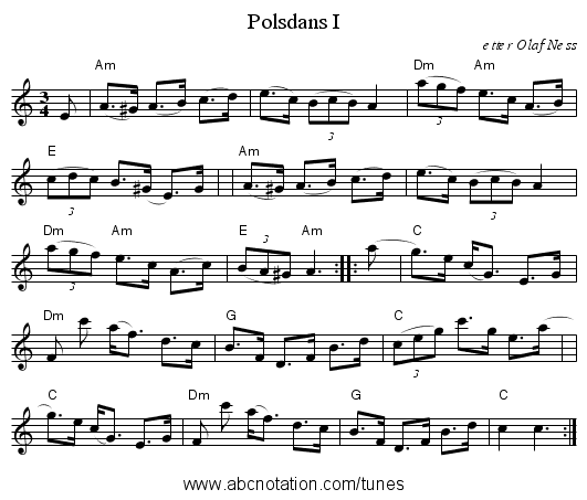 Polsdans I - staff notation