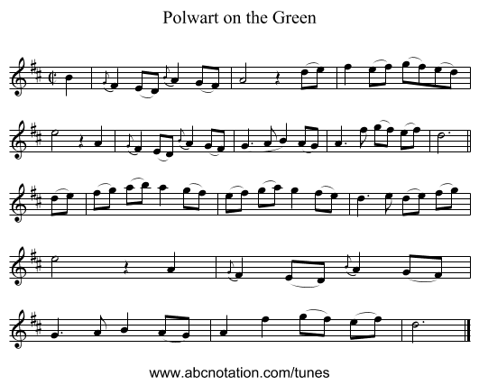 Polwart on the Green - staff notation