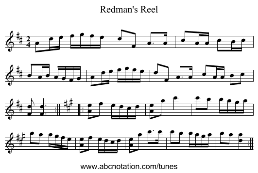 Redman's Reel - staff notation
