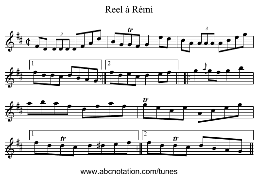 Reel à Rémi - staff notation