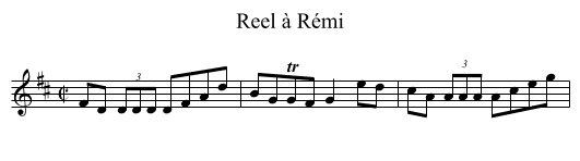 Reel à Rémi - staff notation